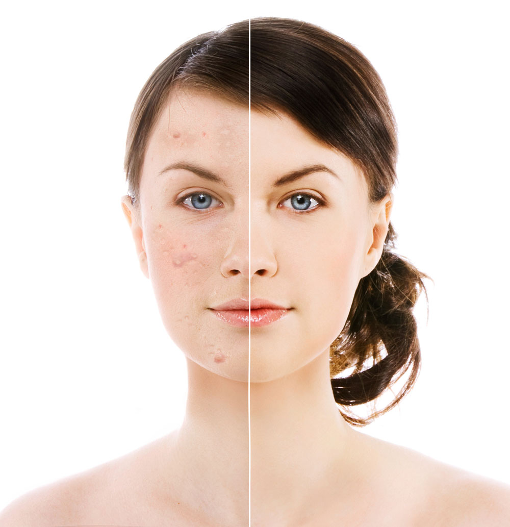 Good for Skin – Behtreen Oil